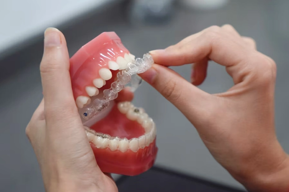 Dental bridges vs. partials: Understanding your options in Shady Spring, WV